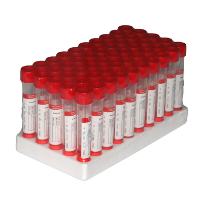 meios virais Kit Inactivation Non Inactivation Sampling do transporte de 2ml VTM
